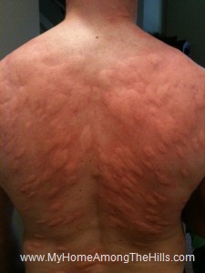 MyBack